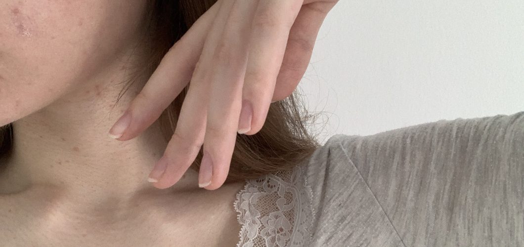 Das hilft wirklich gegen unreine Haut | 20 Tipps aus Paris